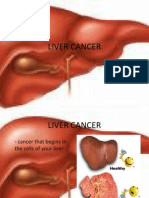 Liver Cancer