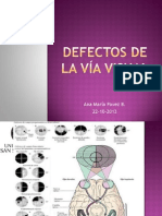 Defectos de La Vía Visual