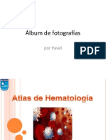 Álbum de Hematologia Isabellll