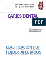 Clasificacion de Caries