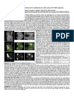 Combining Parallel Multiresolution and PCA Initialization For A Fully Automatic PET-MRI Registration