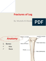 TIBIAL FRACTURES