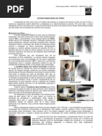 RADIOLOGIA 02- Estudo radiológico do tórax  - MED RESUMOS (JAN-2012)