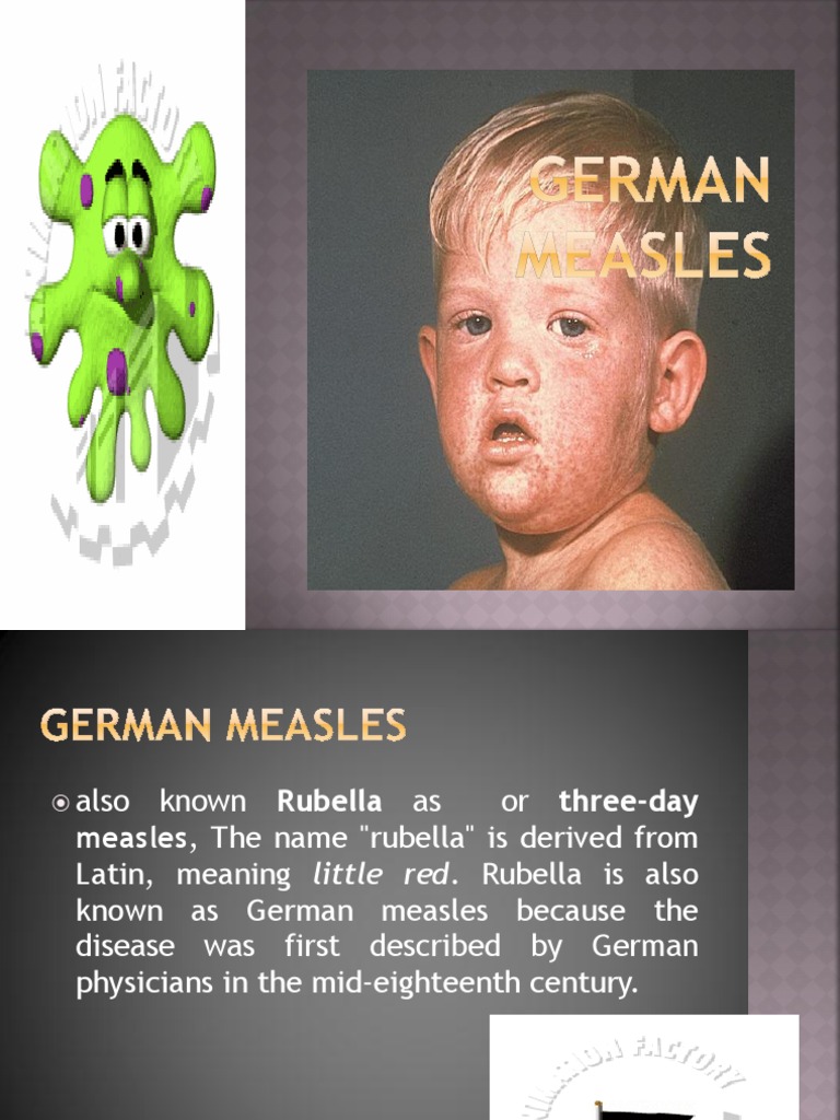 German Measles PDF Measles Congenital Disorder