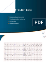 Atelier ECG 2