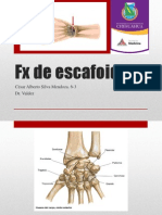 FX de Escafoides