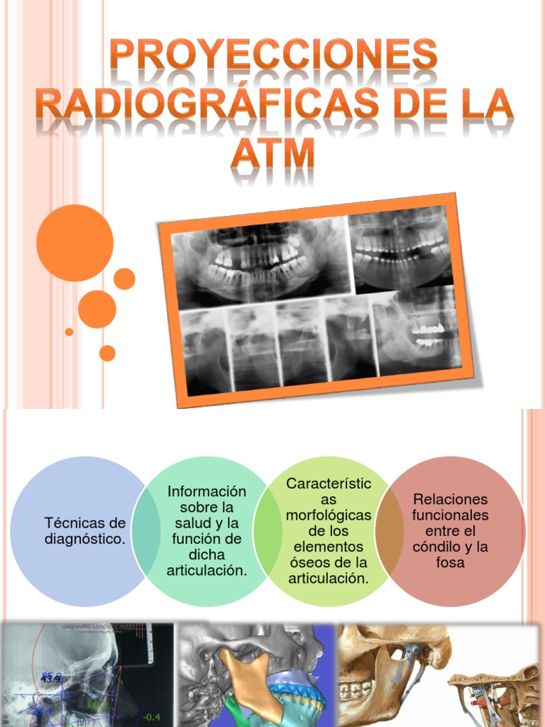 Proyecciones Radiograficas de La ATM | PDF