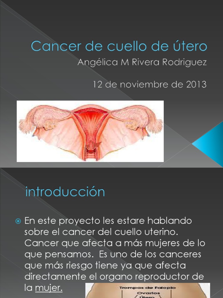 power point cancer de cuello úterino Cáncer de cuello uterino Cáncer