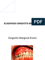 Klasifikasi Gingivitis Kronik