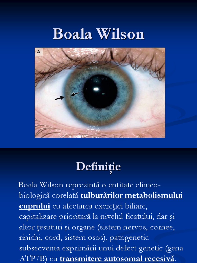 Boala Wilson PDF