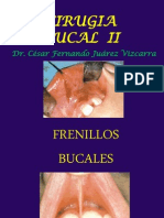 8 Frenillos Bucales