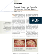 Comparison of Porcelain Veneers and Crowns For Resolving Esthetic Problems: Two Case Reports