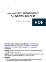 Radiograph Examination On Drowning Case: Debora Braviana