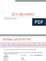 ECG Reading