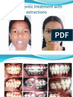 Orthodontic Treatment With Extractions