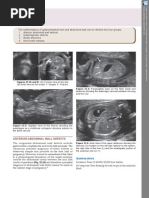 Anterior Abdominal Wall Defects: Figures 22.1A and B: (A) Coronal View On The Lips