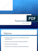 toracocentesis