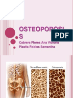 Osteoporosis 2