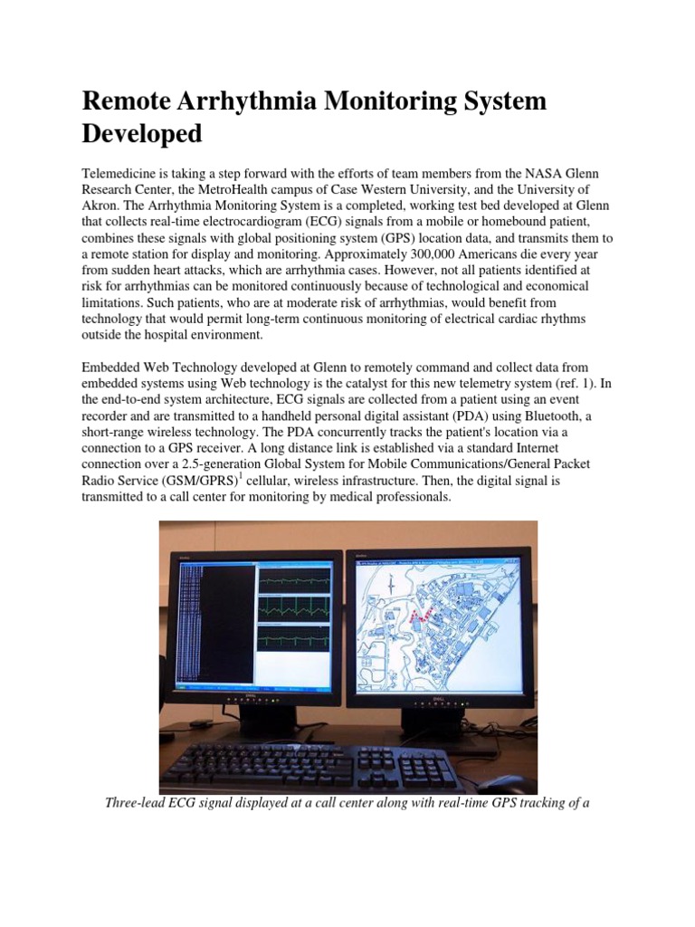 Remote ECG Monitoring with GPS Integration | PDF | Monitoring (Medicine ...