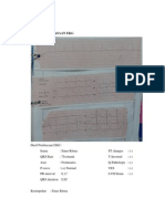 Hasil Pemeriksaan Ekg