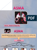 Presentación asma