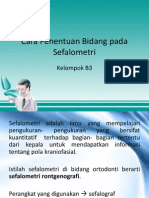 Cara Penentuan Bidang Pada Sefalometri