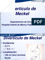 Diverticulo de Meckel