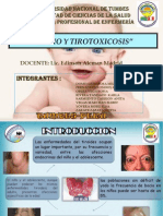 Bocio y Tirotoxicosis 3