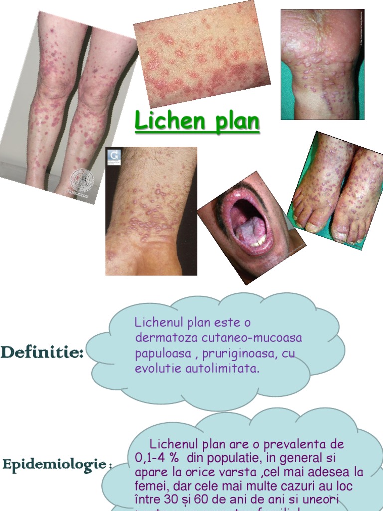 Lichen Plan | PDF