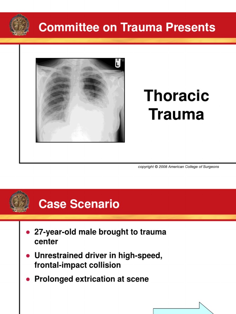 Thoracic Trauma: Initial Assessment Guide | PDF | Major Trauma | Thorax