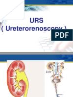 URS (Ureterorenoscopy)