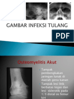 Radiologi Infeksi Tulang