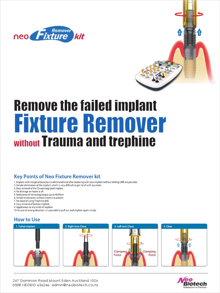Neobiotech Fixture Remover | PDF