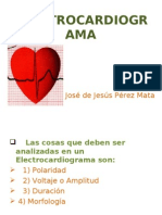 Electrocardiograma