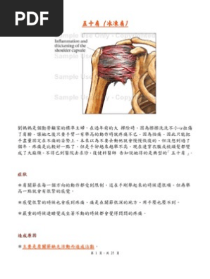 五十肩綜合診療成因病狀及方法 Pdf