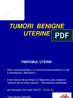 Tumori Benigne Uterine-1