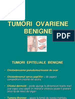 Tumori Ovariene Benigne