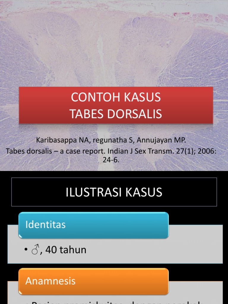 Tabes Dorsalis PDF