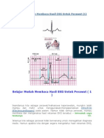 Belajar Mudah Membaca Hasil EKG Untuk Perawat