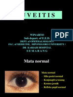 Uveitis Dr Winarto