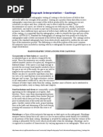 Radiograph Interpretation CASTINGS