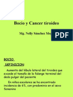 Bocio Cancer