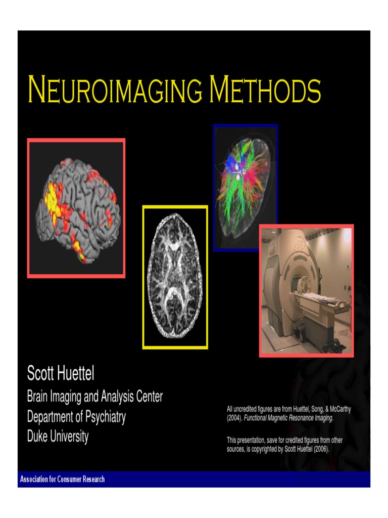Neuroimaging techniques Neuroimaging Electroencephalography