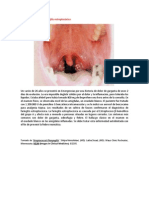A primera vista 401 (Faringitis estreptocócica).docx