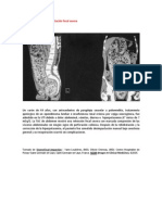 A primera vista 402 (Impactación fecal severa).docx