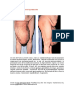 A primera vista 408 (Gran hernia inguinal derecha).docx