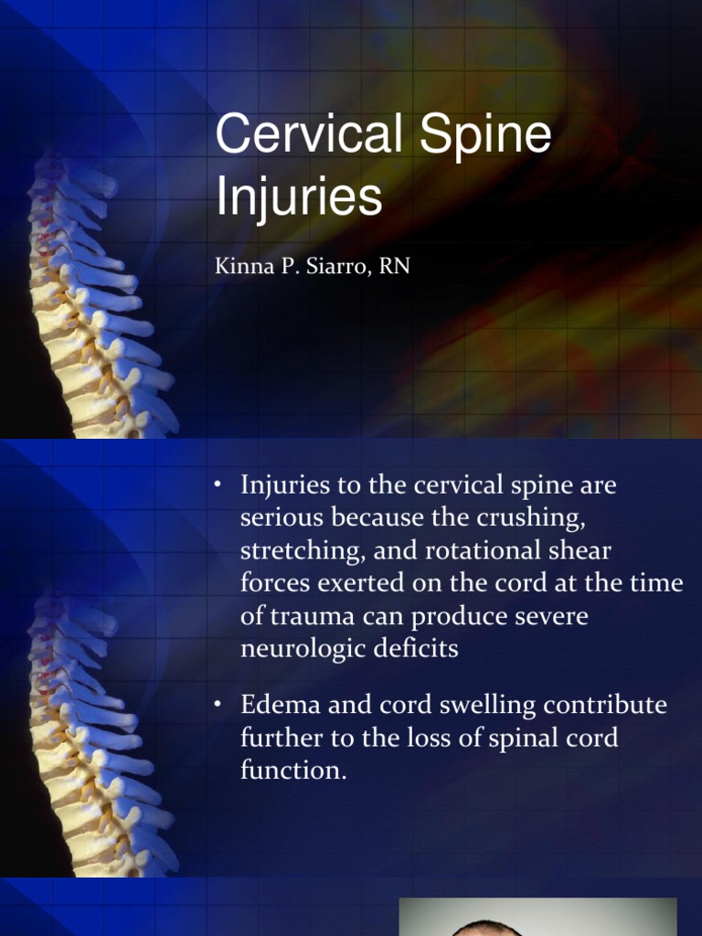 Cervical Spine Injuries Spinal Cord Injury Clinical Medicine