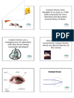 Normal Focus: Iris Cornea