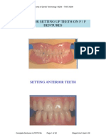 Guide For Setting Denture Teeth On F-F