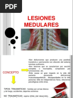 Lesiones Medulares